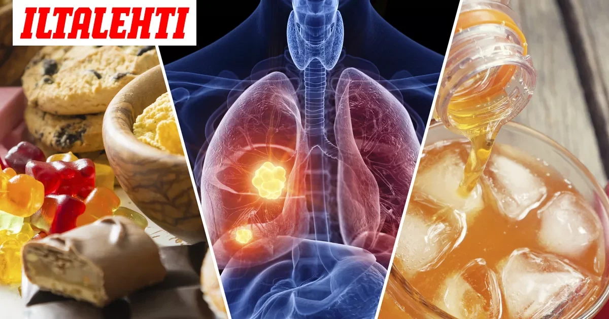 Keuhkosyövän uusi varoitusmerkki: Ultraprosessoitu ruoka nostaa sairastumisriskiä merkittävästi