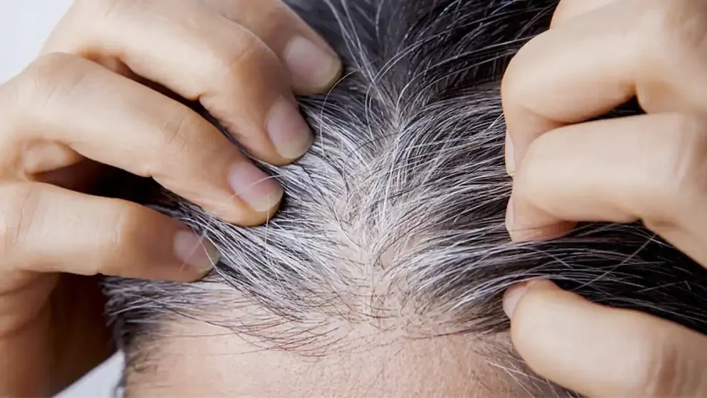 Las canas surgen cuando los folículos dejan de producir melanina, el pigmento que da color al cabello. Imagen: archivo.