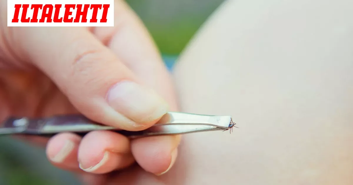 Liha-allergia leviää maailmalla – punkin purema voi muuttaa ruokavalion kohtalokkaasti